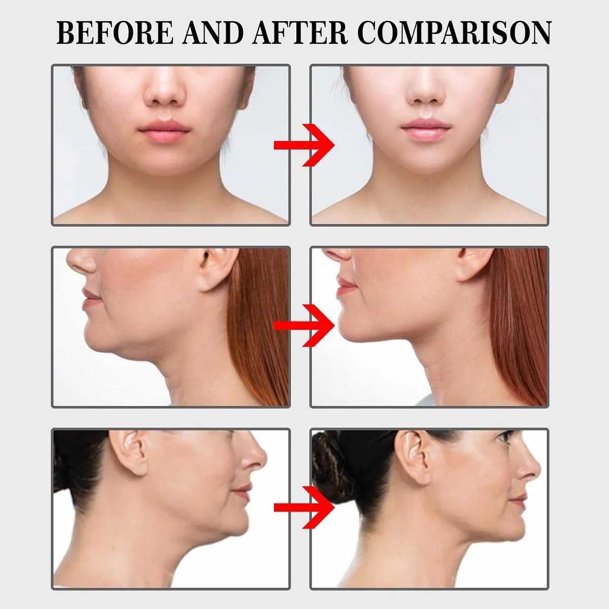 100-Piece Face Lifting Tape Kit — photo 6