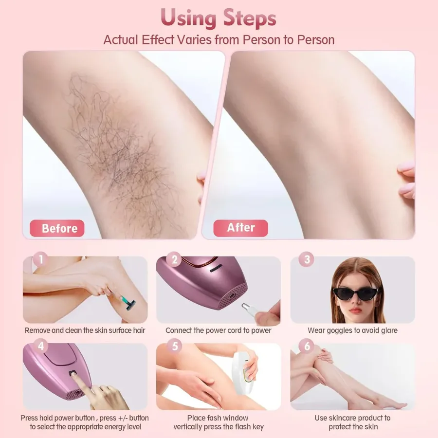 IPL Hair Removal Devices, Hair Removal, Laser Permanent Hair Removal, Laser Hair Remover, - Pink β photo 4