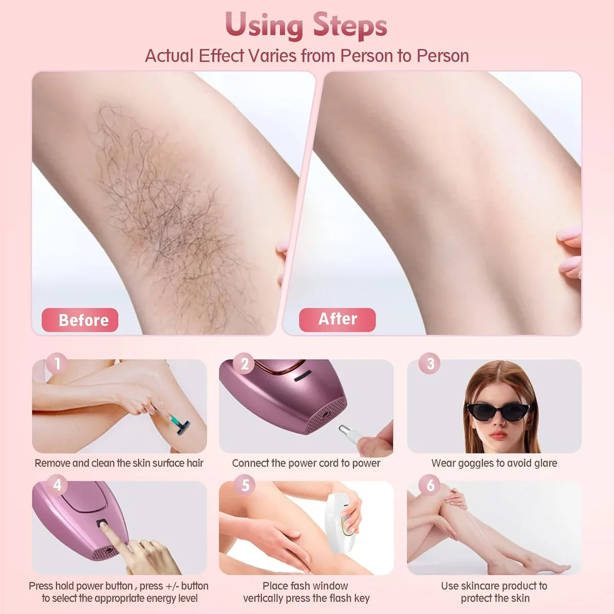 IPL Hair Removal Devices, Hair Removal, Laser Permanent Hair Removal, Laser Hair Remover, - Black β photo 4