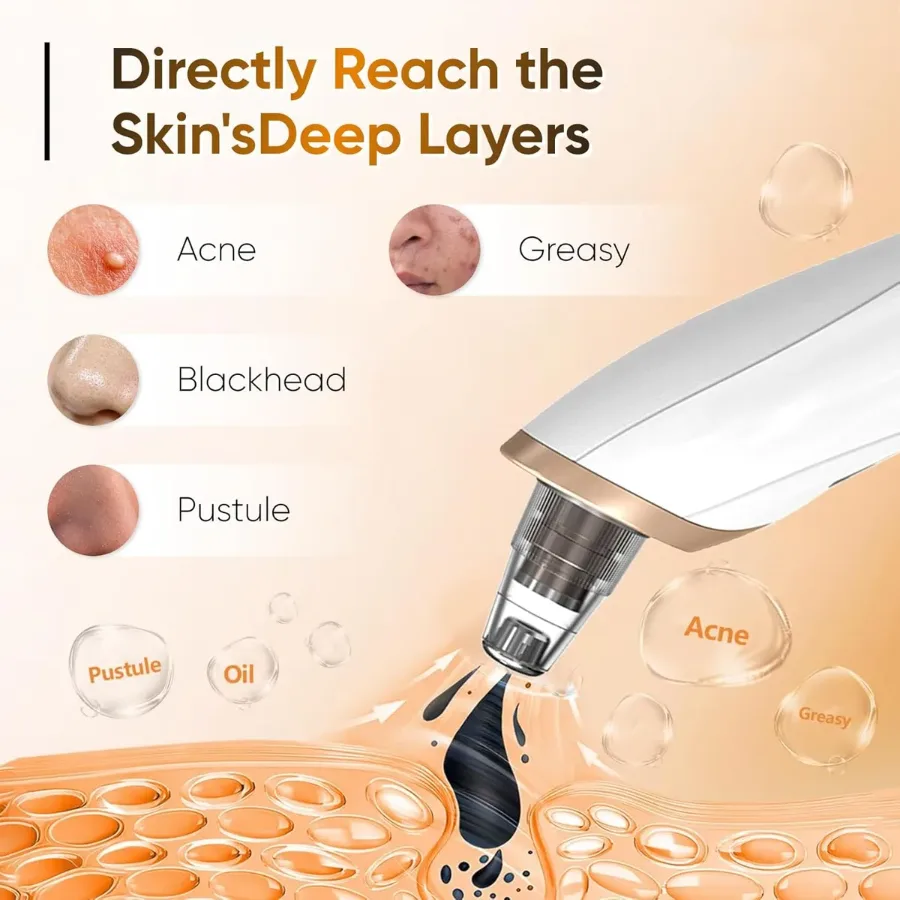 5 in 1 Rechargeable Blackhead Remover Facial Pore Cleaner Deep Cleaning — photo 2